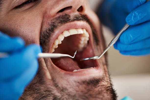 Best After-Hours Dental Trauma Care in Gwinn, MI